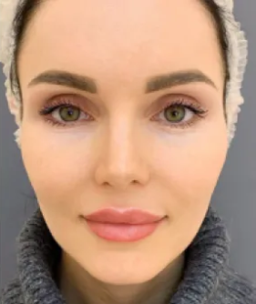 WOW-effect procedure