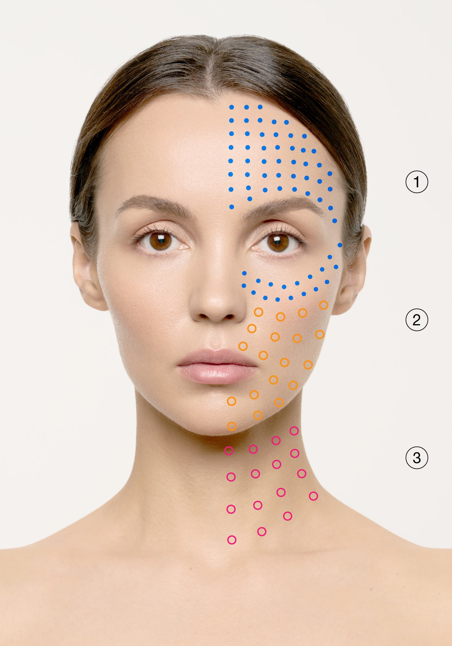 Pigmentation & Rosacea